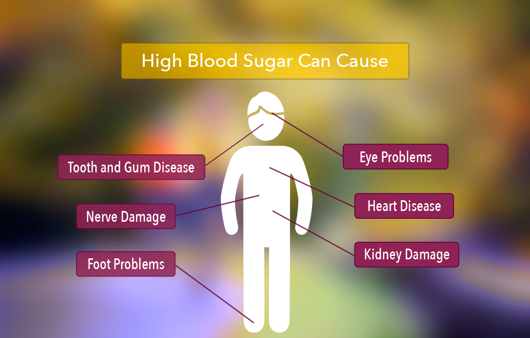 Controlling High Blood Sugar When You Have Diabetes