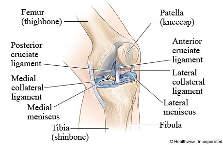 Knee Ligament Injury: Causes and Healing a Ligament tear
