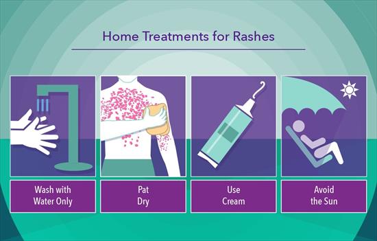 What You Need To Know About Rashes