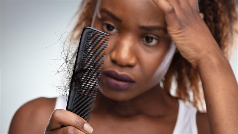 Losing Your Hair? COVID May be the Culprit