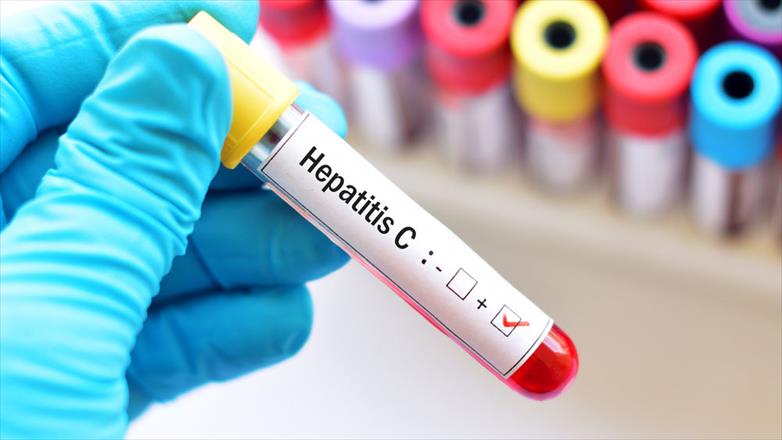 Hepatitis C: How to Stay Healthy and Prevent Complications