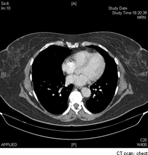 CT Scan | My Doctor Online