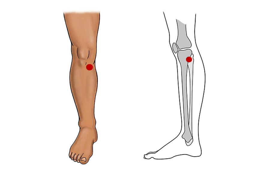 Press These Points to Reduce Knee Pain Naturally