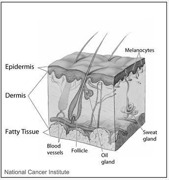 Melanoma | My Doctor Online