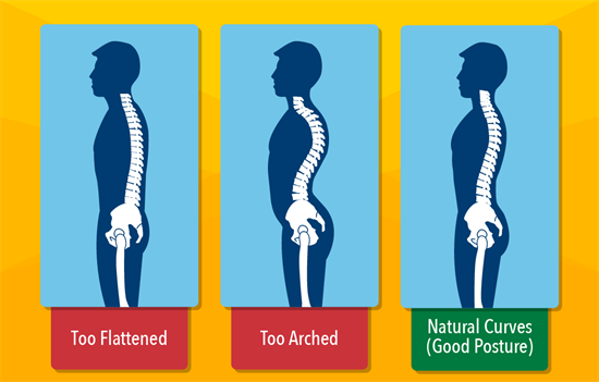 Good Posture | My Doctor Online