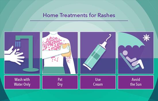What You Need To Know About Rashes My Doctor Online