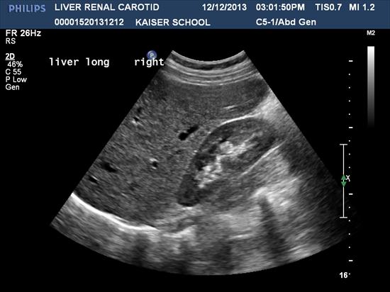 Ultrasound My Doctor Online