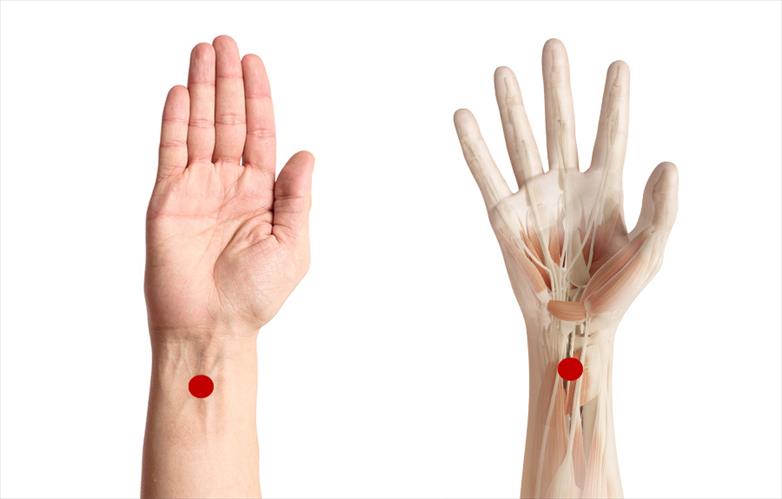 Can Acupuncture Help With Carpal Tunnel Syndrome?